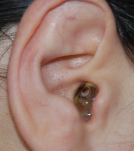 Earasures in the ear